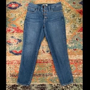 Madewell Button-Front “Curvy Roadtripper” Skinny Jeans